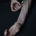 神経筋疾患児の成長発達段階ごとのリハビリテーション戦略