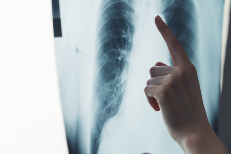 誤嚥性肺炎を防ぐための具体的な食事介助技術